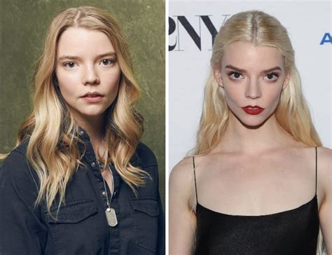 anya taylor-joy surgery|Did Anya Taylor